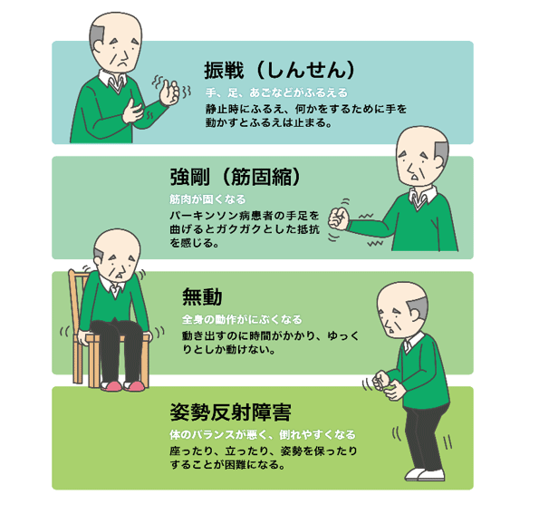 パーキンソン病 -その2