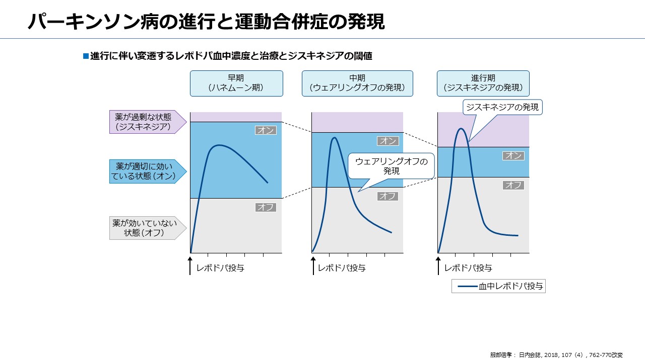 パーキンソン病治療デバイス「ヴィアレブ」について
